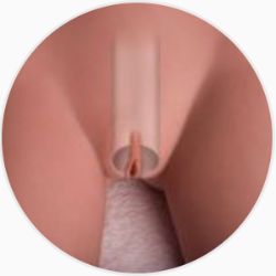 Removable TPE vagina