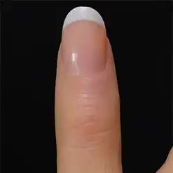 Natural