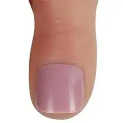 No.7