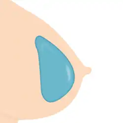 GEI