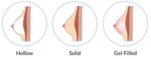 Breasts Type