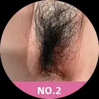 Pubic Hair #2